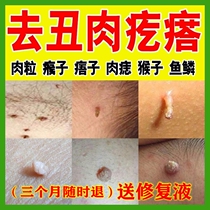 Remove the spines the underarms of the neck the small meat removal cream the thorns of the monkeys the spines the bumps the knots the moles the gnaws the armpits