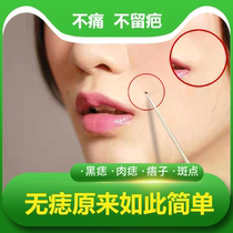 To remove the mole no trace water and cream to remove the spotting water artifact pen special instrument for facial beauty salons