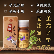 Zhous go to the spirit cream to remove the hand and foot cream Thorn monkey meat Thorn hand foot calluses especially the foot pad fish scale mole