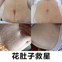 Orville postpartum removal and dilution prevention of stretch marks Belly Belly lines repair cream Olive oil for pregnant women