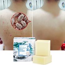 Anti-mite soap Face non-sulfur Anti-mite full body face Deep cleansing Female and male anti-mite soap