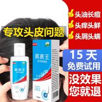 Kangwang anti-itching and anti-dandruff shampoo 100ml for men and women to remove dandruff serious artifact oil control shampoo