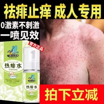 Prickly heat anti-itch water adult anti-prickly heat spray liquid anti-prickly heat cream to treat heat removal prickly heat water adult anti-Philippine artifact medicine