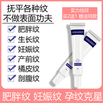 Get rid of stretch marks Repair cream Pregnant women postpartum eliminate firming to thighs Pregnant Chen lines Obesity lines Growth lines Students