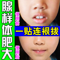 Special traditional Chinese medicine nozzle for gonad-like body hypertrophy facial-conditioning childrens rhinocerosis and large ventilation aligner