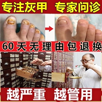 Wang Huangs official website Shenfang Huangs Zhenwang cream Astragalus cream antibacterial antipruritic ointment