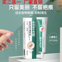 Special acne marks for scar pimples dilute childrens facial surgery repair cream Stretch marks scalding scalding cream caesarean section