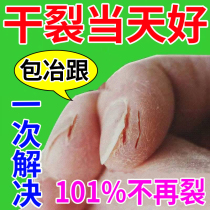 Finger cracking healing cream (removing chapped that night) dry skin and peeling heel cracking prevention ointment