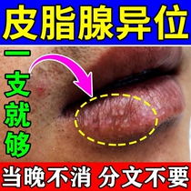 Sebaceous ectopic lips) dry cracked peeling blistering dead skin long fat particles small white dots pimples