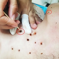 No scab where is not clean where to remove all black spots on the face spots fade to black shots 2 hair 3