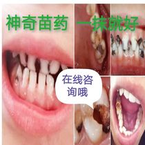 Pain Relief Repair Cavities Cavities Corrosion Fractures Swollen and painful rotten teeth Periodontitis Plaque Adult tooth decay Bad breath