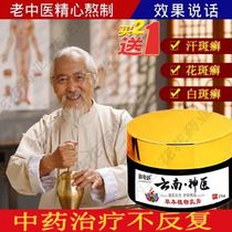 Treatment of tinea versicolor tinea vulgaris adult skin topical medicine Sweat Moss tinea versicolor leukoplakia tinea vulgaris special tinea ointment