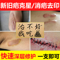  Remove hyperplastic adenocarcinoma repair cream scar cream paste surgical scars Remove bump scars postoperative scar stitches smoke scars