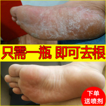 Beriberi root removal artifact Anti-itch peeling bactericidal spray Rotten feet erosive deodorant sweat Foot soak water package for itchy feet