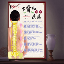 Chinese Medicine Spine related disease schematic wall sticker wall sticker spine hologram sticker poster physiotherapy hanging picture