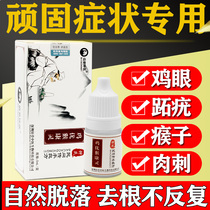 Zhongs ancient prescription chicken eye medicine plantar warts special medicine for treating wart thorns thorns removing artifact corns and corns