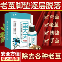 Cocoon doctor painless removal of calluses foot pads hand cocoon corns wart spines soften thick cocoon joints to cocoon artifact