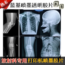 Medical film inkjet Blue Film blue-based dry radiology print film dental fracture X-ray DR CT