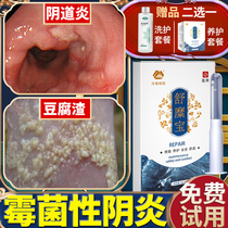 Private gel Candida bean curd trichomoniasis fungal feminine vulvar inflammation vaginal care itching lotion bactericidal antibacterial