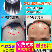  Hairline wig stickers Mens m-shaped forehead fake bangs hair patch artifact real hair Invisible biological scalp short hair