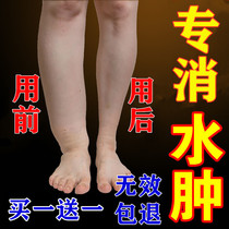  Go to the lower extremities for edema and swelling eliminate the old mans feet calf face face whole body edema discharge puffiness artifact stick to the foot
