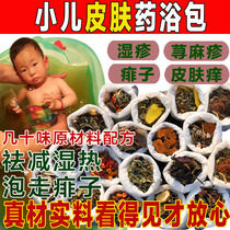 Childrens hot eczema skin pruritus anti-itching Traditional Chinese medicine bath bath package Baby prickly heat infants and young children allergic dermatitis medicine package