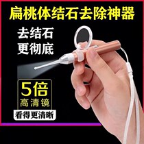 Tonsil calculi removal tool visualization household removal glow to avoid retching tone cleaning crypt swelling
