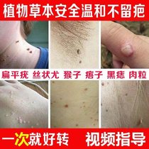 Verruca plana yi mo ling meat warts will rule si zhuang you 5-fluorouracil cream five Fluorouracil ointment