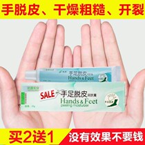 Medicine for hand peeling Seasonal repair cream Fingers palms Hands Molt cracking Chapped hands peeling Dry peeling