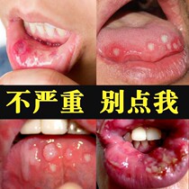 Qing Qing Wei Xin spray (official) buy 2 get 1 Wei Xin oral fresh spray breath agent persistent type