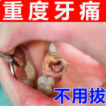 Toothache medicine relieves gum swelling pain inflammation tooth pain pain relief quick-acting medicine pulp artifact wisdom tooth decay tooth fire spray