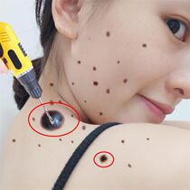 Dont scab dont clean where removed face all black spots fade to black shoot 2 of 3