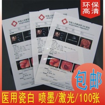 Hospital film Porcelain white inkjet film A4 film Gastroscopy B ultrasound four-dimensional color ultrasound printing paper 100 sheets