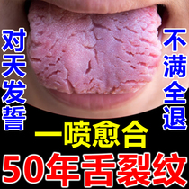 Tongue cleft map tongue tongue spray oral foaming rotten mouth tongue dry crack red swelling pain relief glossitis artifact
