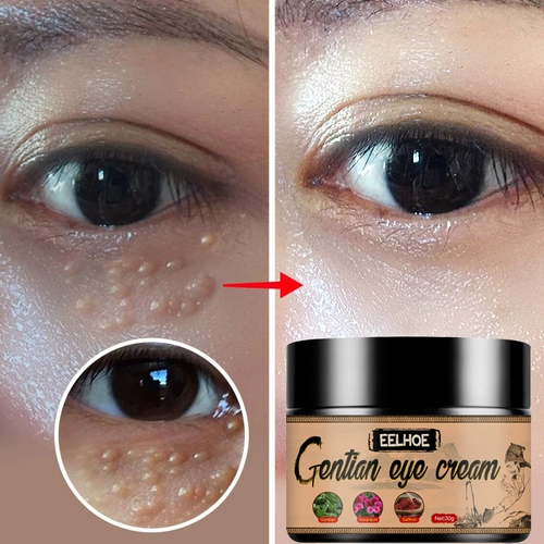 Fat Granules Remover Eyes Cream Improve Eye Bag Fade Fine Li