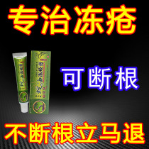 Frostbite cream antipruritic frostbite cream childrens ears face hands and heels anti-cracking and swelling root winter antifreeze cream