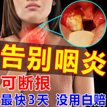 Pharyngeal flat patch Childrens tonsillar hypertrophy swelling inflammation childrens adult stones sore throat sore throat