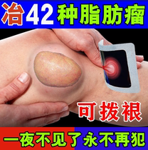 Fat whole body subcutaneous tumor removal artifact anti-tumor plaster to eliminate hard block Single-Shot multiple special stickers