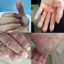 (Small red book with the same model) Li Jiaqi recommended ~ hands and feet dry and peeling a touch easy to restore buy 2 get 1