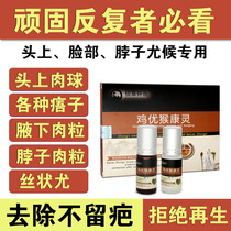 Remove the long neck of the small meat pimple the armpit remove the ointment the monkey drug the sarcoma the convex nevus artifact.