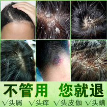  Jiu Su anti-dandruff anti-itching shampoo Medical dandruff serious special shampoo shampoo in addition to mites for men and women