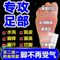 National Speed West Linji small white bottle beriberiberi treatment blistering peeling rotten feet medicine erosion itching toe crack itching