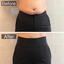 Collection of Loose Tight Waist West Pants Woman Straight Drum 9 Sub-pants Pants Commute Spring Big Code South Korea East Gate