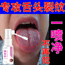Tongue thickness white tongue nipple inflammation tongue coating thick greasy tooth marks Moss yellow and blistering