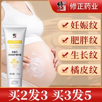 Pregnant women special prevention stretch marks postpartum Repair Cream fade obesity lines skin care pregnancy pattern