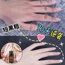 Comic hand nurturer finger joint massager silicone ball multi-function roller kneading Meridian beautiful hand slender