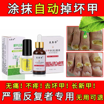 (Buy 3 get 1 free)Meikangjing gray nail antibacterial liquid set Meikangjing nail removal gold putty nail net
