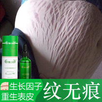 Postpartum removal of stretch marks Stomach Elimination of pregnant Chen lines Firming repair of Renchen lines Obesity lines Growth lines Thigh products