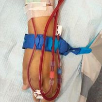 Dialysis fixed infusion analysis medical Pipeline Fixed hand belt blood transfusion multi-functional fixed anti-detachment patent