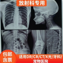 Dry blue-based film medical radiology film DR CR CT X-ray nuclear magnetic resonance dental film inkjet Blue Film